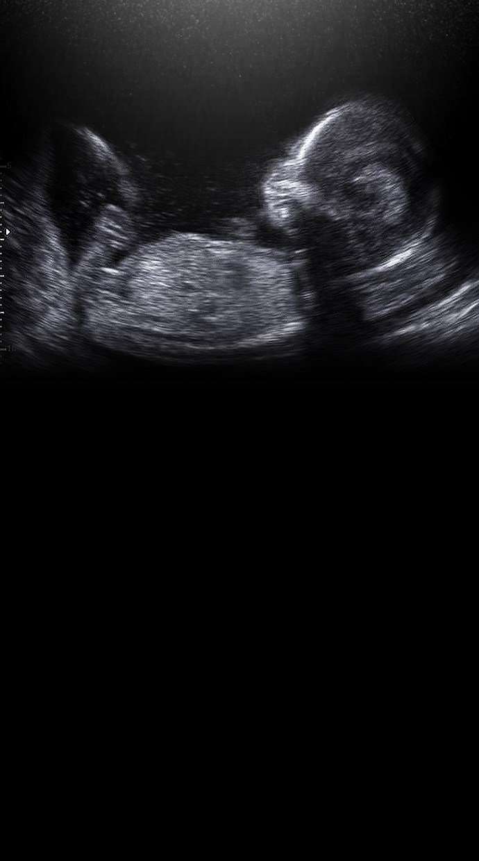 Reawaken Man Chapter 170 Image 80