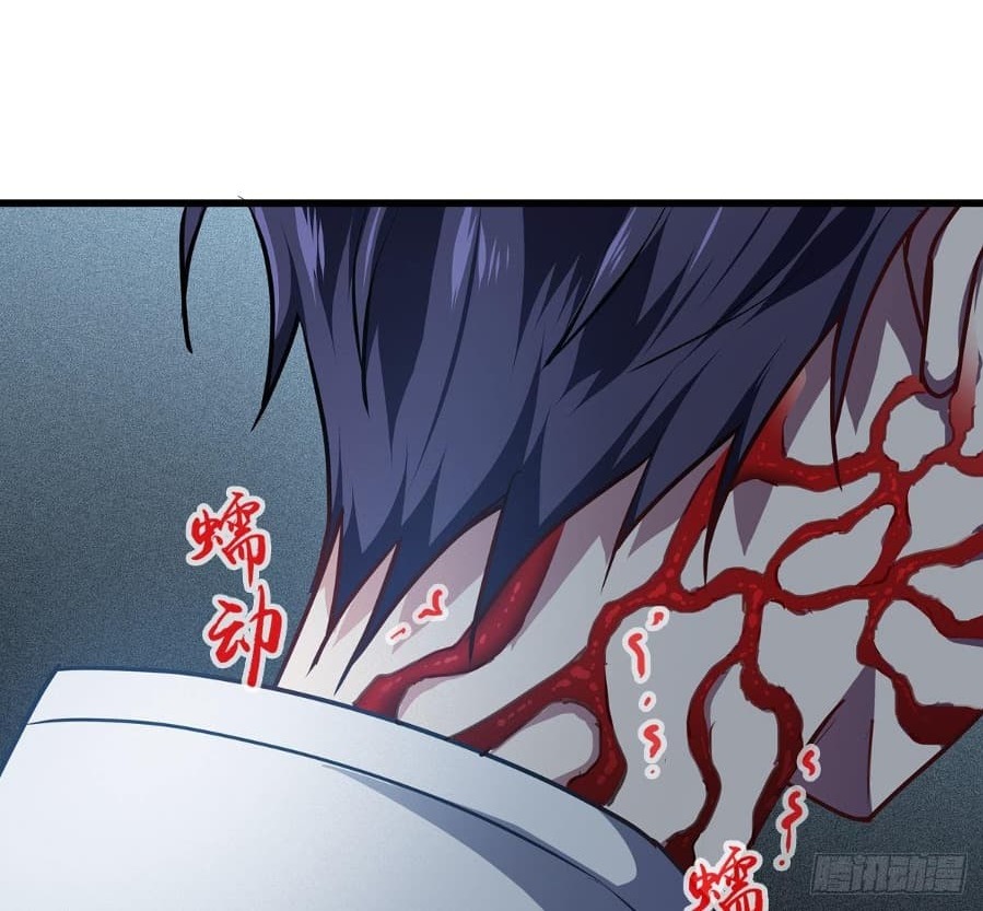 Became King After Being Bitten Chapter 15 Image 30